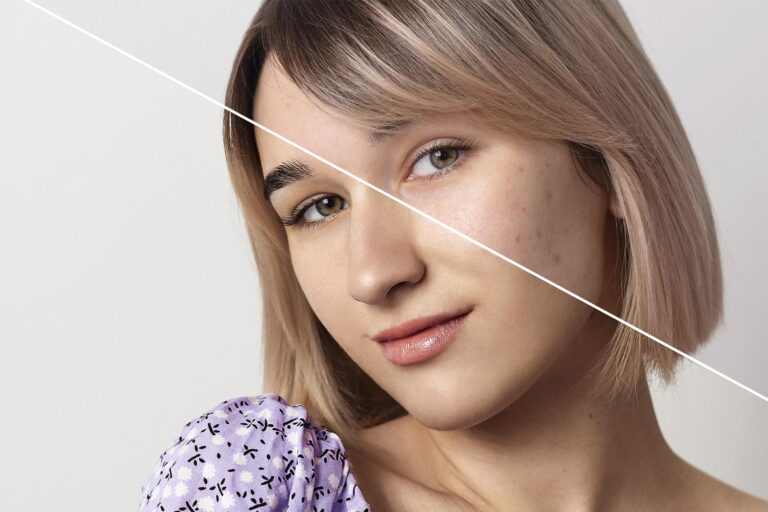 El Rejuvenecimiento Facial